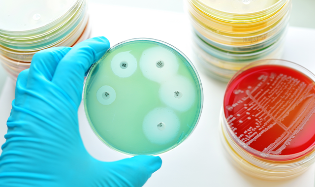 antibiotic resistance testing on Petri dish
